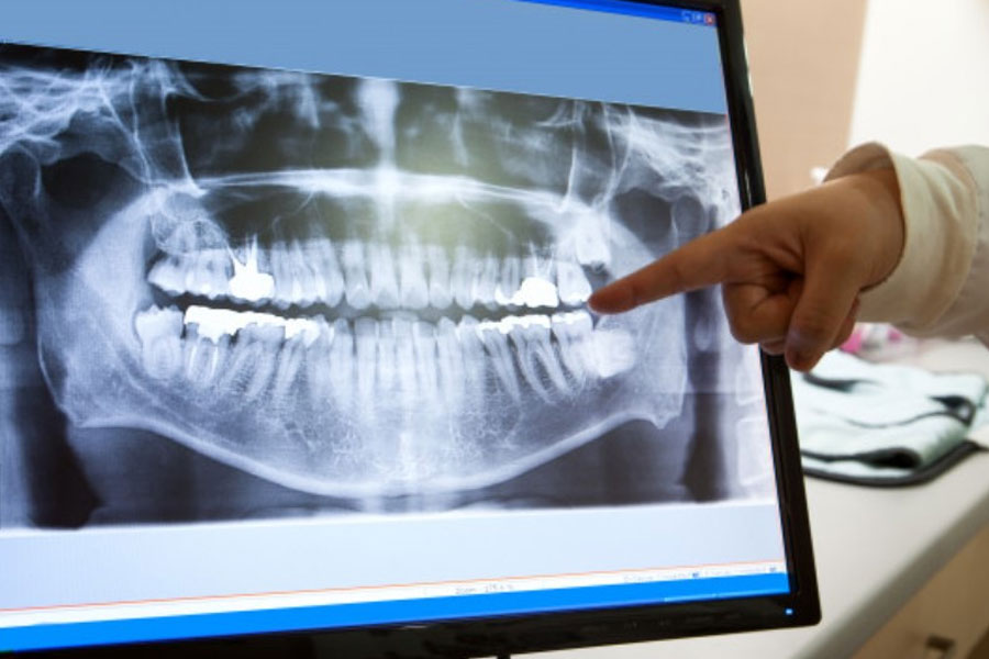 Zobni rentgen Luxdental